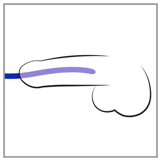 You2Toys – Sada silikonových dilatátorů (3 ks)