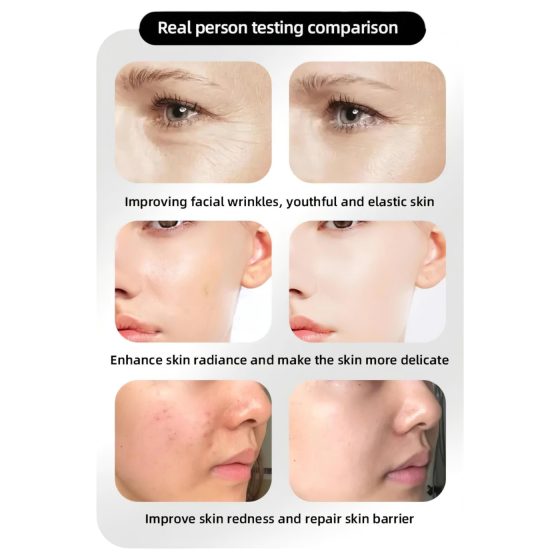 Photon Rejuvenation LED pleťová maska